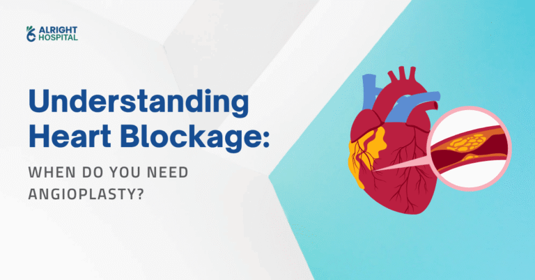 Understanding Heart Blockage: When Do You Need Angioplasty?
