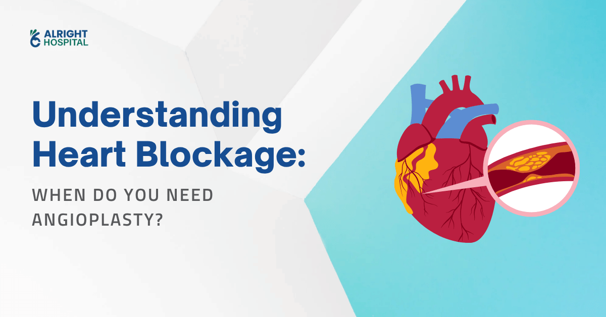 heart blockage diagram showing plaque buildup in coronary artery