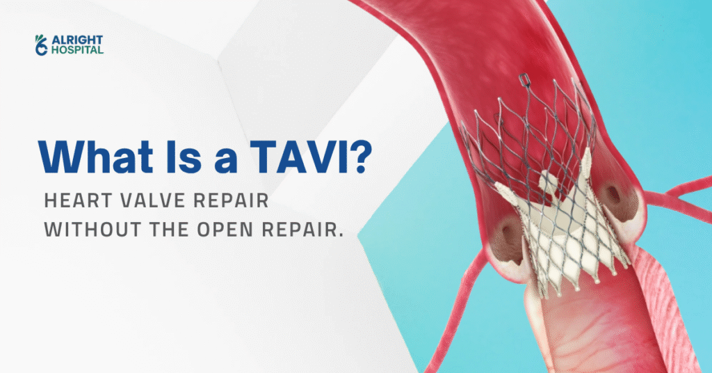 TAVI - Transcatheter Aortic Valve Implantation
