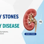 kidney stone vs kidney disease