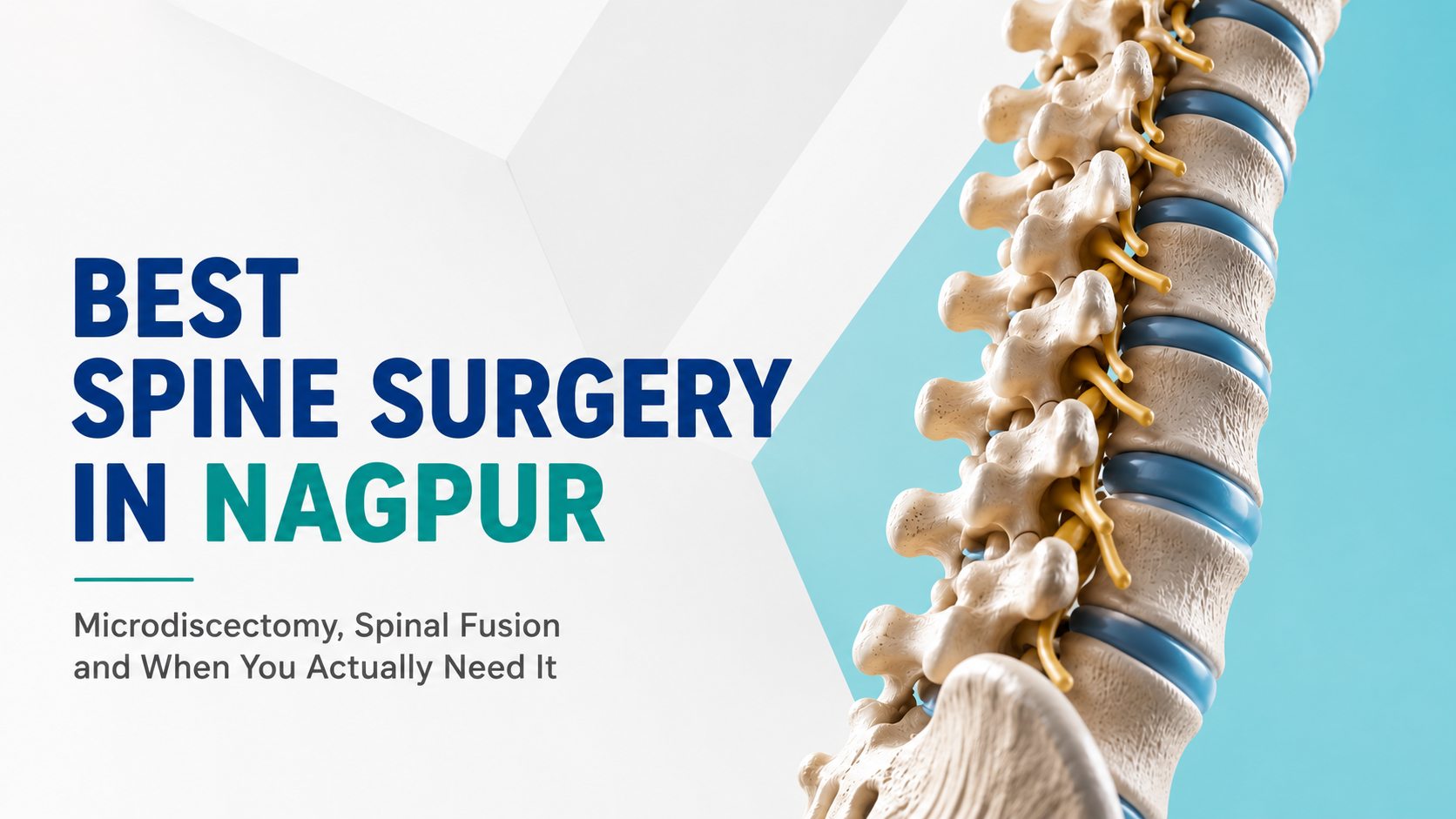 Best Spine Surgery in Nagpur: Microdiscectomy, Spinal Fusion and When You Actually Need It