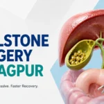 "gallstone ultrasound diagnosis Nagpur", "laparoscopic cholecystectomy keyhole surgery Nagpur", "gallbladder anatomy and gallstone formation diagram", "Alright Hospital general surgery team Nagpur"