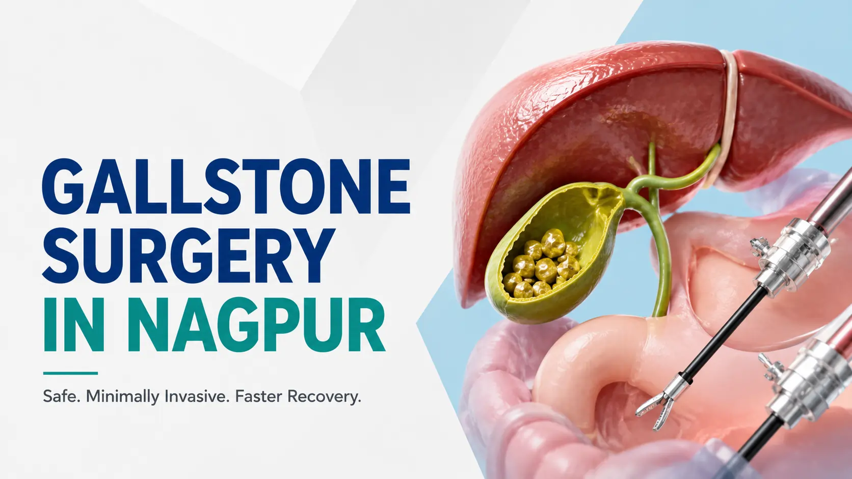 Gallstones Surgery in Nagpur: Symptoms, Ultrasound Diagnosis and When Laparoscopic Surgery Is the Right Answer