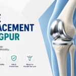 Knee Replacement in Nagpur