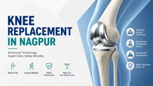 Knee Replacement in Nagpur